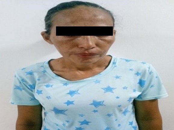 Adolescente se tomó un blister de pastillas por los malos tratos de su madre Adolescente se tomó un blister de pastillas por los malos tratos de su madre