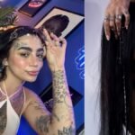 una modelo muere tras someterse a una cirugía estética